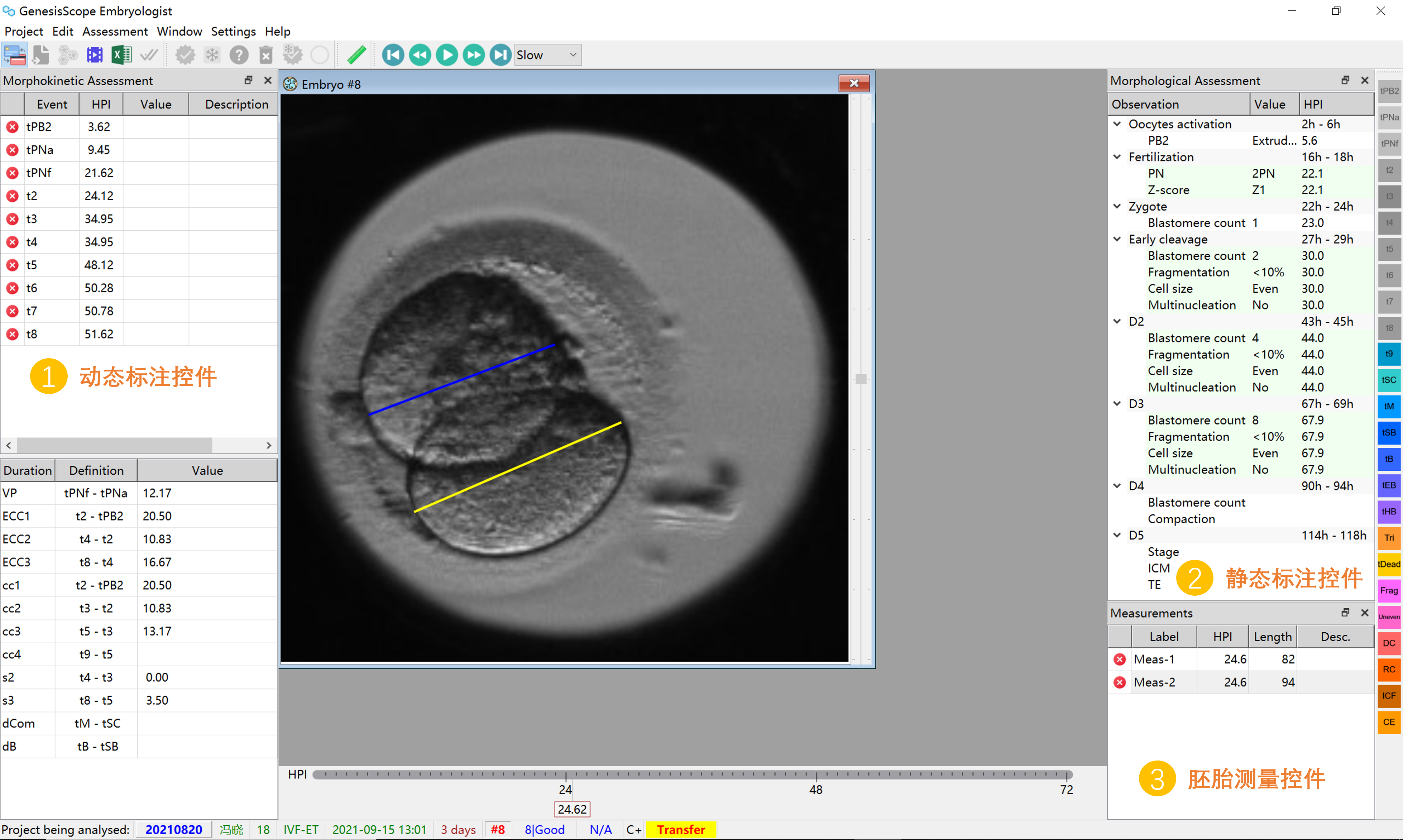 GenesisScope胚胎学家分析软件界面